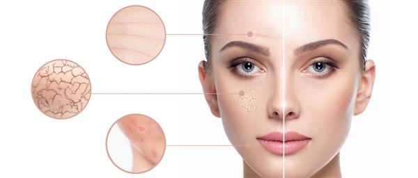 سرم هیالورونیک اسید کوزارکس