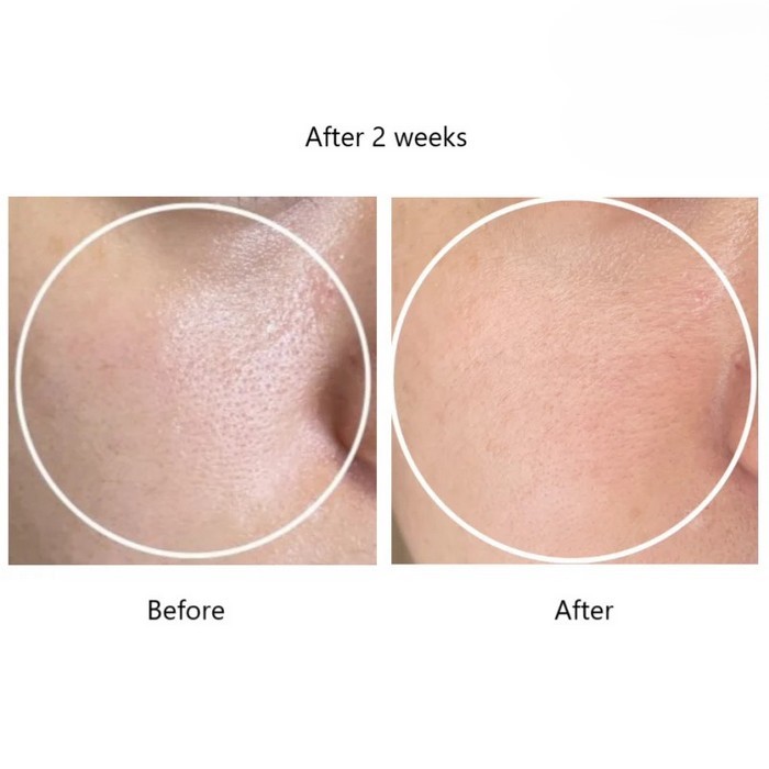 طریقه مصرف ریتل شات ۱۰۰