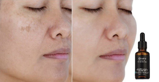 ویژگی‌های برجسته سرم ضد لک راکوتن