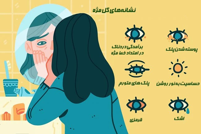 علائم گل مژه