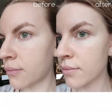 آمپول کنترل منافذ اسکین ۱۰۰۴ اصل کره 100 میل thumbnail