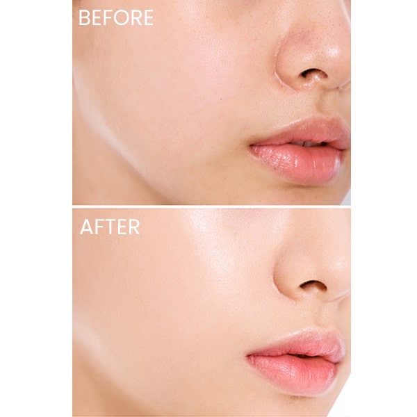 آمپول ماداگاسکار سنتلا تون اسکین 1004 حجم 50 میل